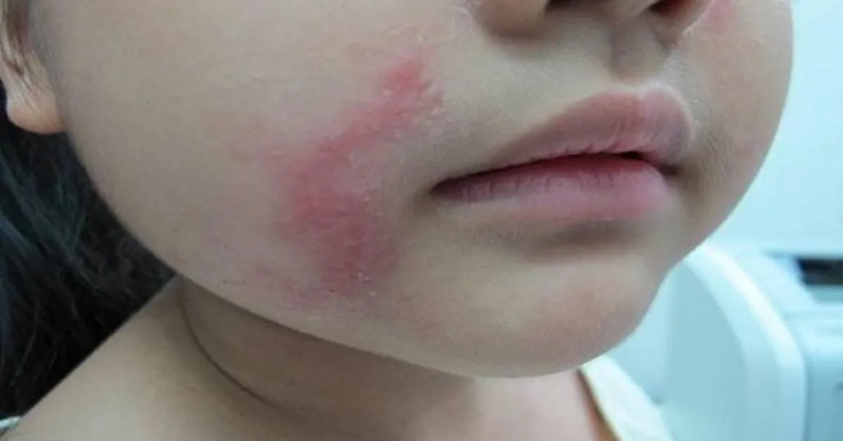 kiến ba khoang đốt