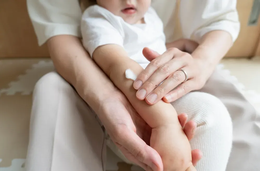 phòng ngừa côn trùng đốt cho trẻ