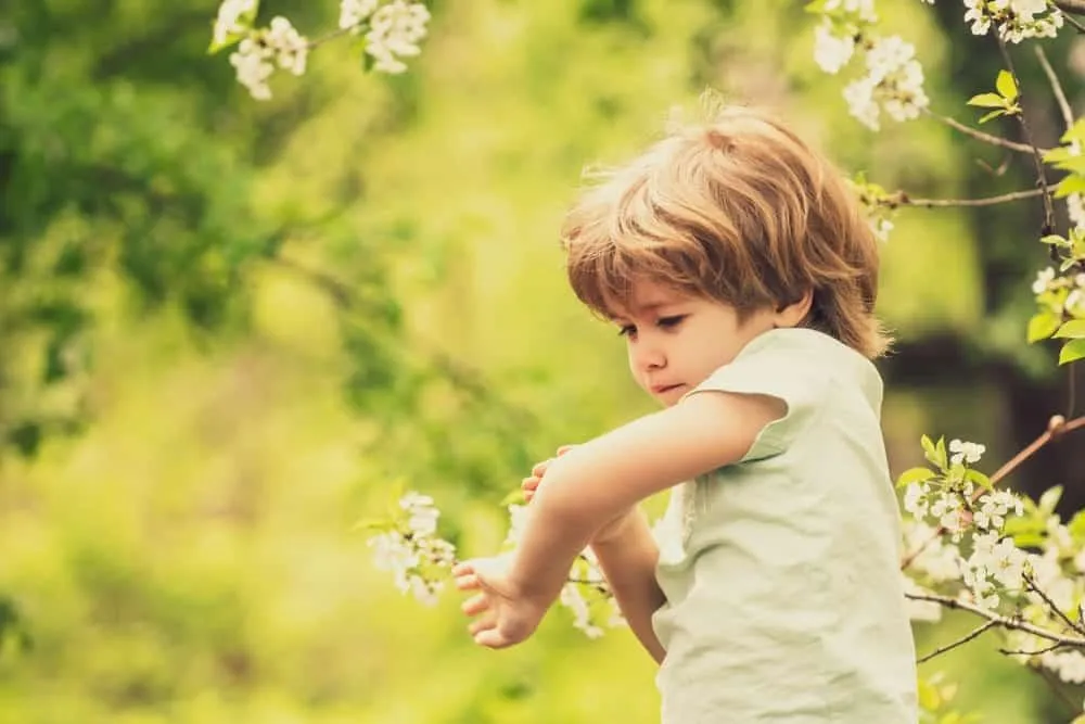 Bé bị côn trùng cắn sưng tấy: Cần chăm sóc và điều trị như thế nào?