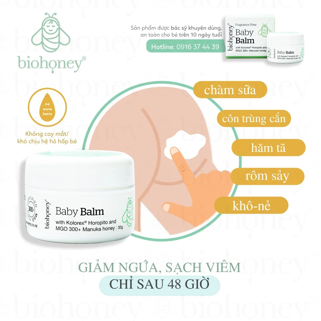bị côn trùng cắn bôi gì cho bé và người lớn khi ngứa nhiều