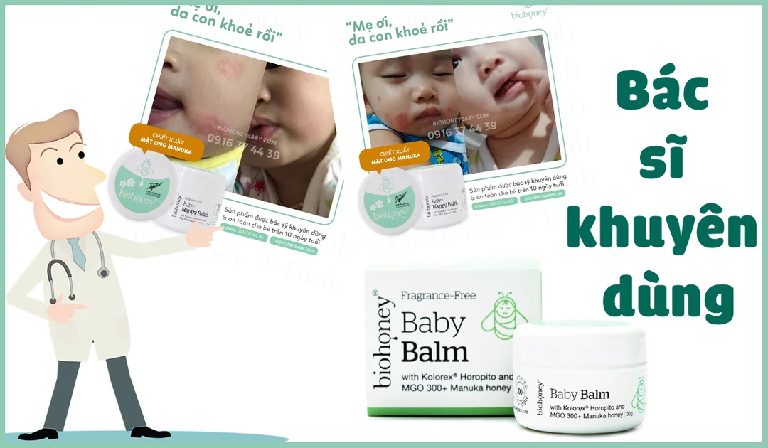 bị côn trùng cắn bôi gì và khi nào cần đi khám bác sĩ da liễu