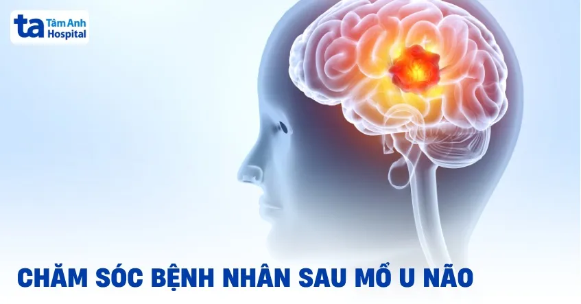 chăm sóc bệnh nhân sau mổ u não