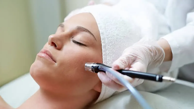 Chăm sóc da sau khi trị nám bằng laser giúp làn da nhanh chóng phục hồi