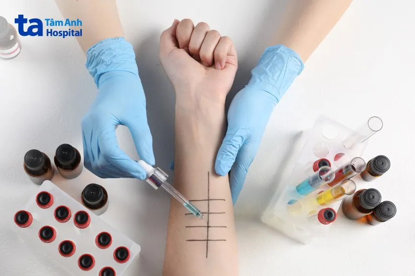 quy trình chẩn đoán dị ứng khi tiếp xúc với các loại côn trùng thường gặp