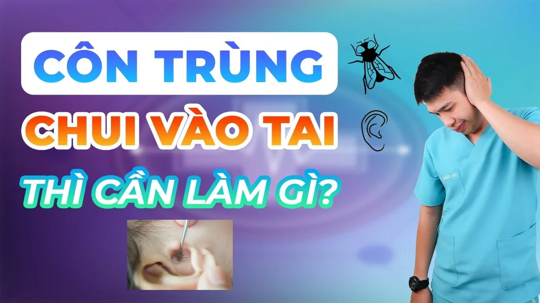 Côn trùng chui vào tai thì làm gì - xử lí dị vật tai
