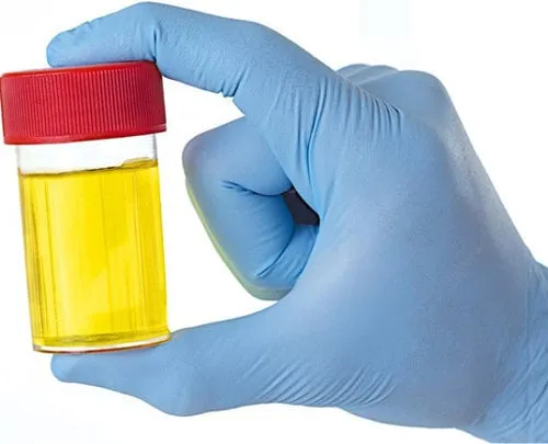 6-tac-dung-chang-ai-ngo-khi-te-bay-trong-vuon-phantrunque4