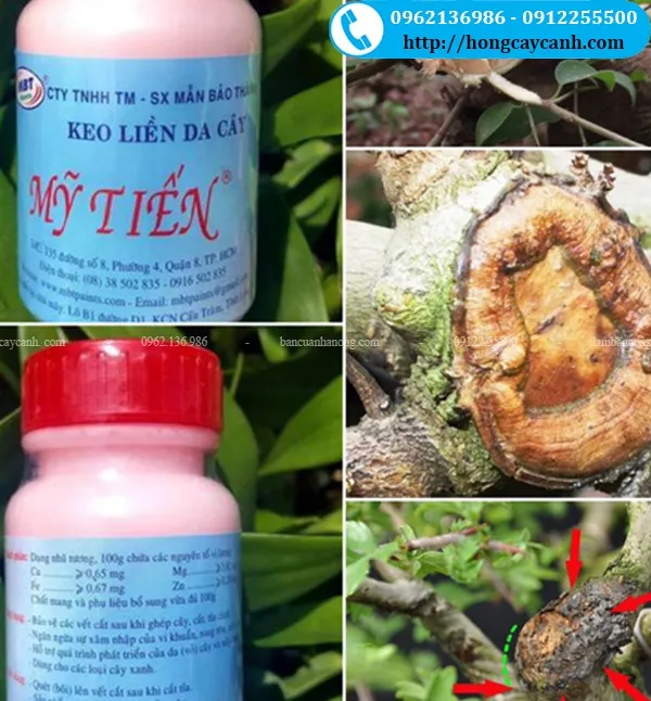 Keo Liền Da Mỹ Tiến