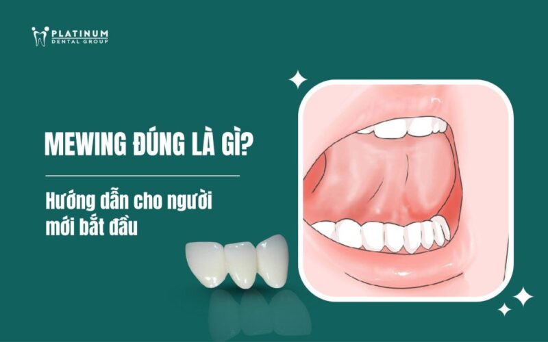 Hướng Dẫn Chi Tiết cách trồng cây mai tứ quý: Từ A-Z Cho Người Mới Bắt Đầu