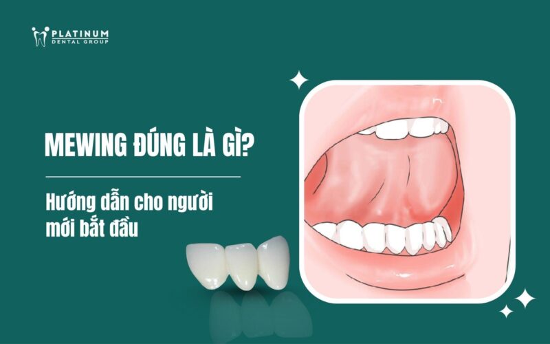 Hướng Dẫn Chi Tiết cách trồng cây mai tứ quý: Từ A-Z Cho Người Mới Bắt Đầu