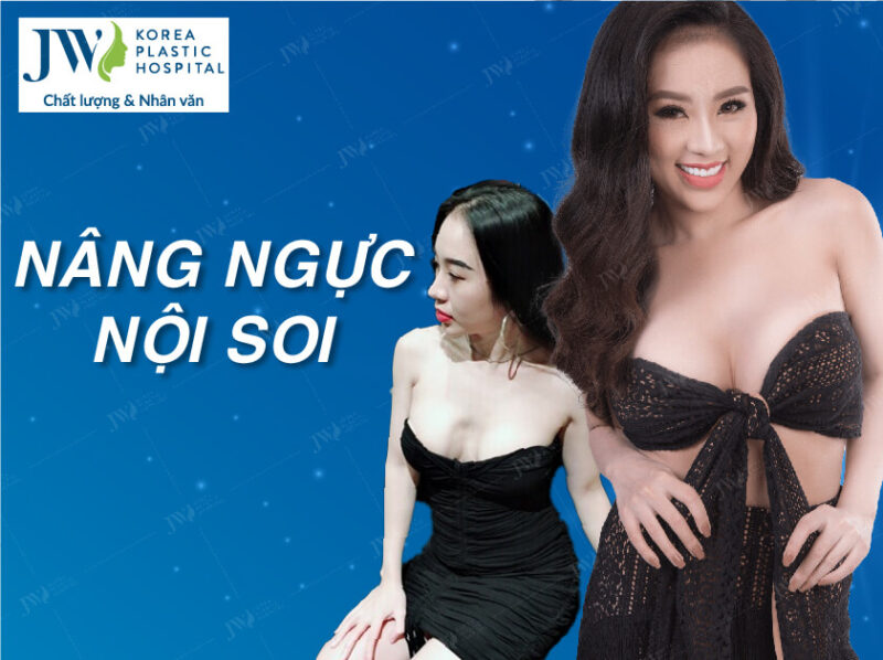 Nâng Ngực: Cẩm Nang Chi Tiết Về Phương Pháp Làm Đẹp Vòng Một