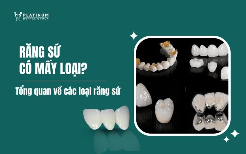 Các Loại Giá Thể Cây Trồng Phổ Biến Và Cách Lựa Chọn Hiệu Quả Nhất