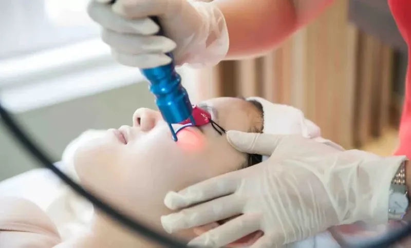 Chăm sóc da sau khi đốt tàn nhang bằng laser để tránh vết thâm