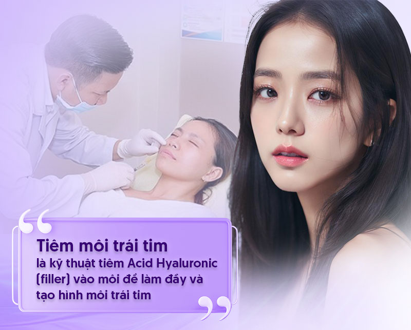 Những Điều Cần Biết Về khuôn tạo hình trái cây