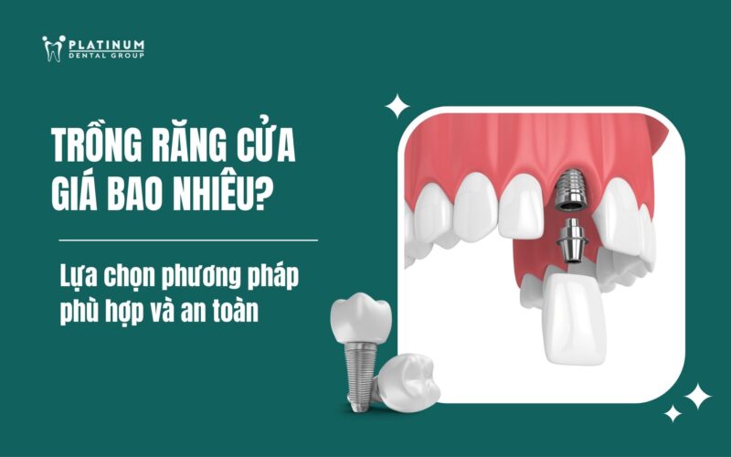 Lựa Chọn Lý Tưởng: Các Loại Cây Thường Trồng Trong Trường Học Giúp Không Gian Xanh Mát, An Toàn
