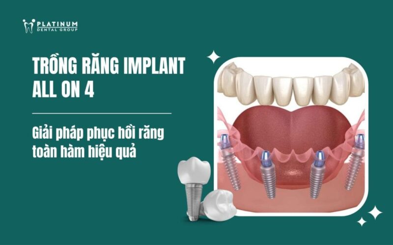 Trồng Cây Xanh Trong Nhà: Hướng Dẫn Chi Tiết Từ A-Z Để Mang Thiên Nhiên Vào Không Gian Sống