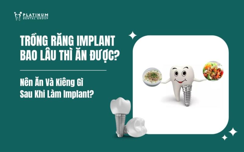 Trồng Cây Xanh Để Làm Gì? Top 10 Lợi Ích Và Kinh Nghiệm Chăm Sóc Toàn Diện