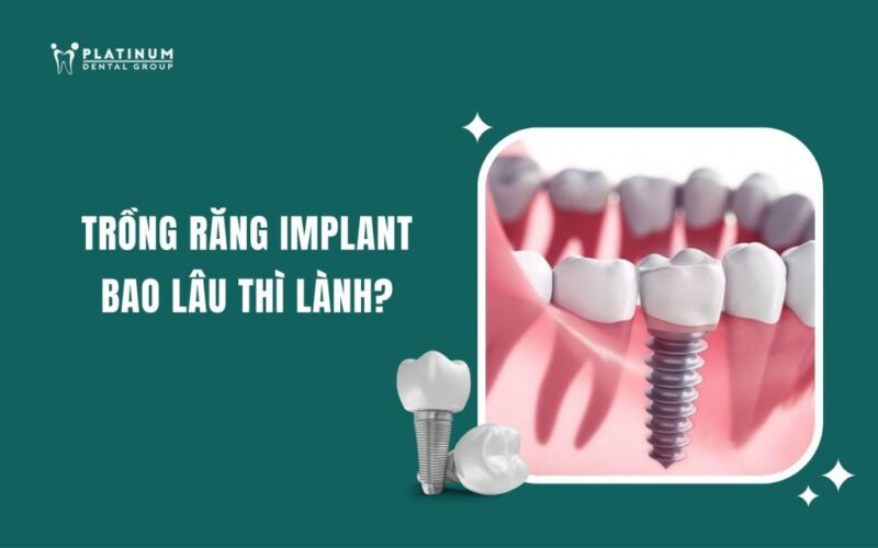 Trồng Chanh Dây Bao Lâu Thì Có Quả? Hướng Dẫn Chi Tiết Từ A-Z