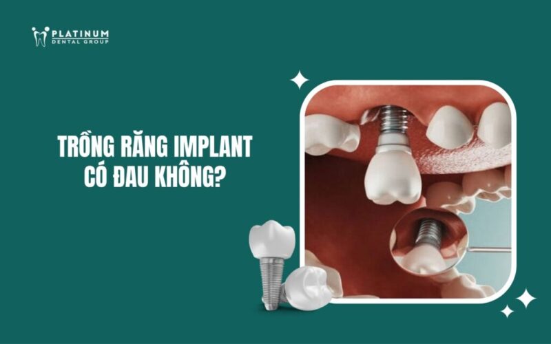 Trồng Cây Lấy Gỗ Nhanh Nhất: Lựa Chọn Thông Minh Cho Tương Lai Bền Vững