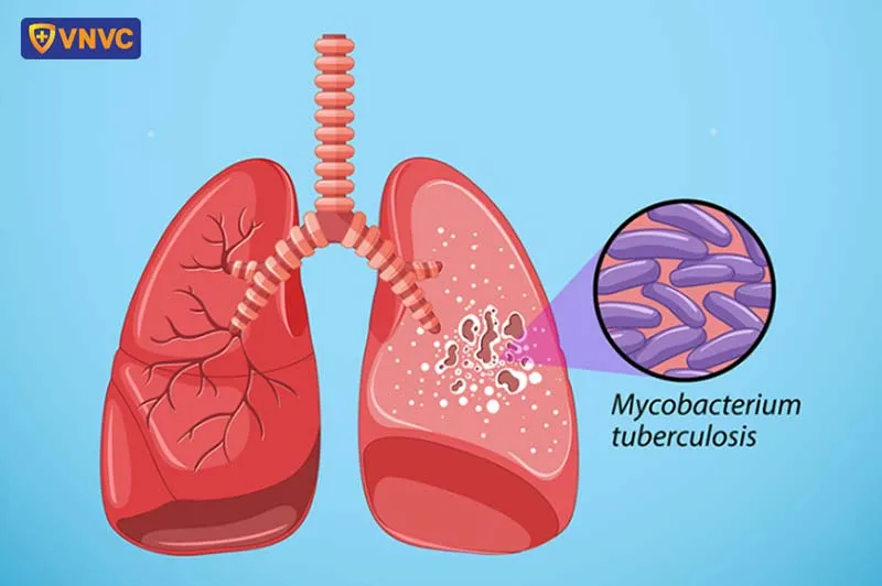 Kỹ thuật viên đang kiểm tra túi chứa các chủng vi khuẩn phòng ngừa côn trùng có hại