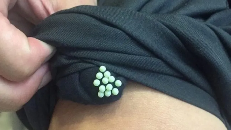 Trứng côn trùng trên quần áo dễ xảy ra khi bạn phơi chúng ở gần cây cối