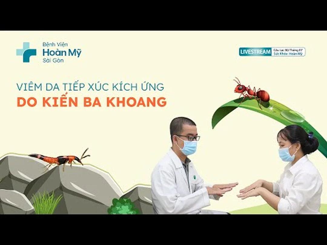 Video nhận biết và xử trí viêm da tiếp xúc do kiến ba khoang