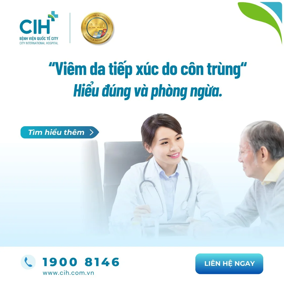 Xử trí viêm da tiếp xúc côn trùng bằng thuốc bôi theo chỉ định